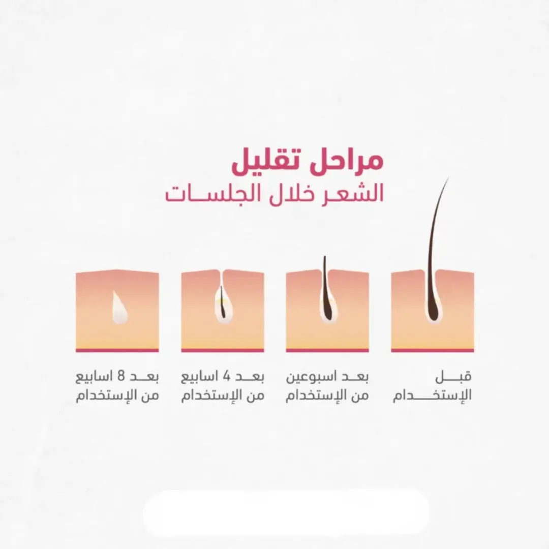 مراحل تقليل الشعر خلال الجلسات ليزر ملاي T14